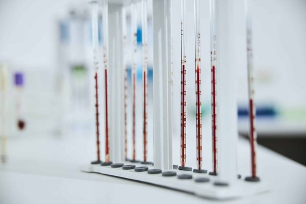 Conversion de volumes : tout ce que vous devez savoir sur cl en ml